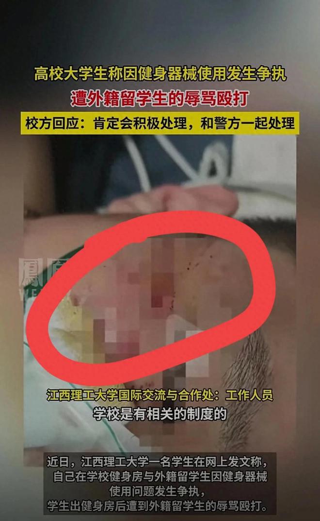 大学生遭外籍留学生辱骂殴打！因健身发生争执各方回应来了(图1)